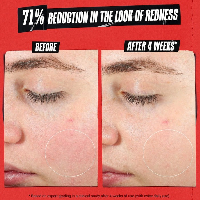 Ultra Facial Meltdown Recovery Medicated Cream with Colloidal Oatmeal - GLAM MODA